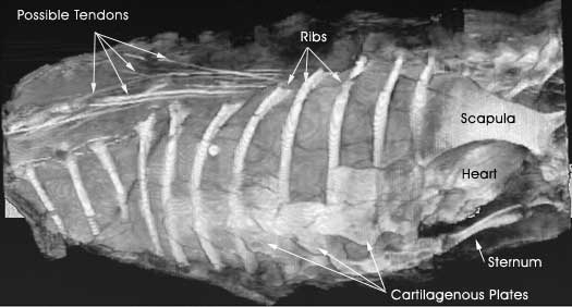Complete view